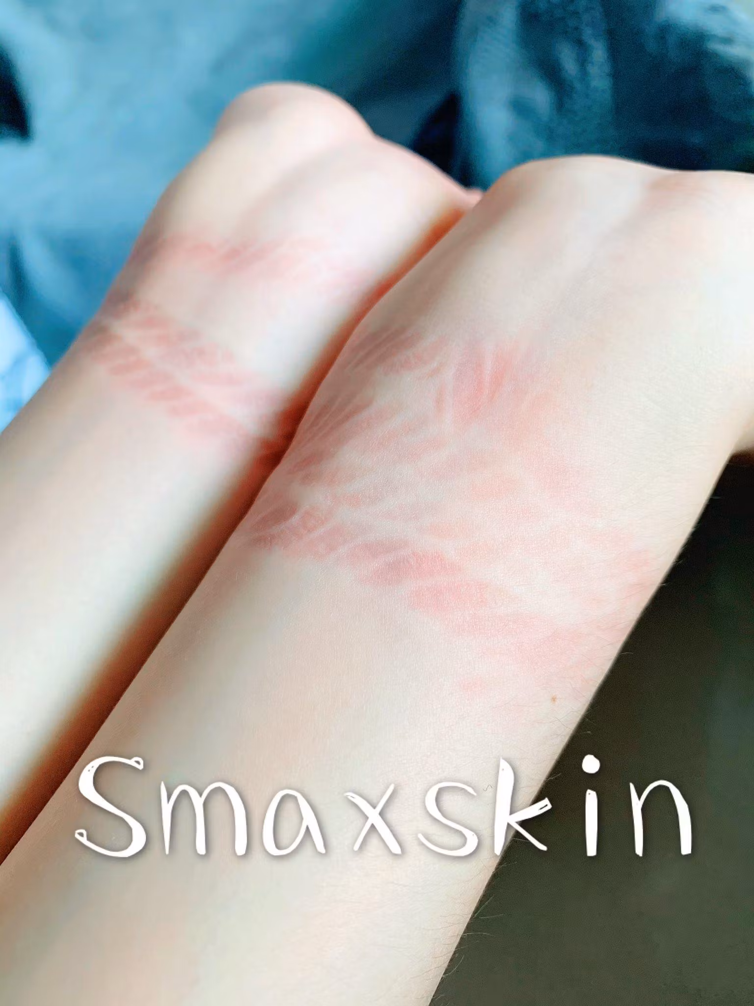 Smaxskin写真
